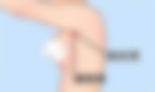 郑州艾丽菲整形医院特色项目及技术优势