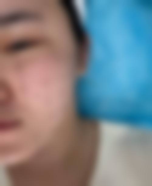韩国釜山哈娜尔整形外科与徐盛益院长的就诊保护