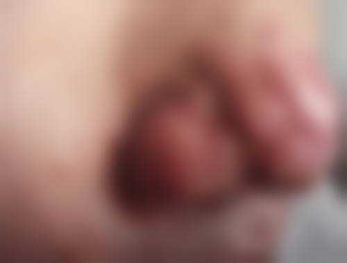 深圳新兴皮肤病专科门诊部简介概述