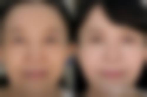 内蒙古绣颜挚美医疗美容诊所求美者反馈