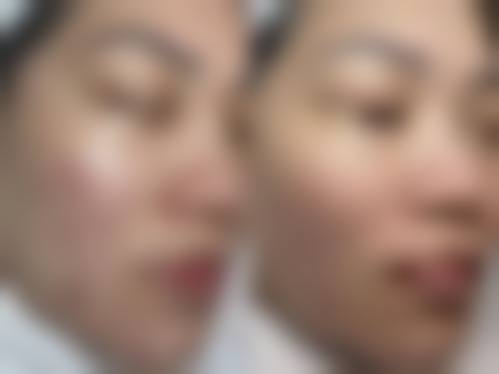 魏芳主治医师可开展的特色医美项目