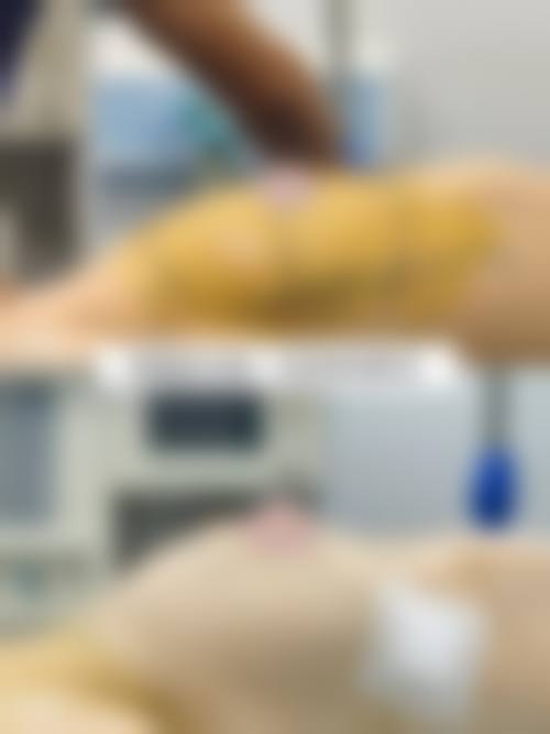 长春焕颜整形医院求美者反馈