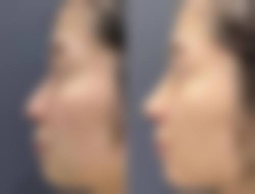 烟台壹美医疗美容医院特色项目及技术优势