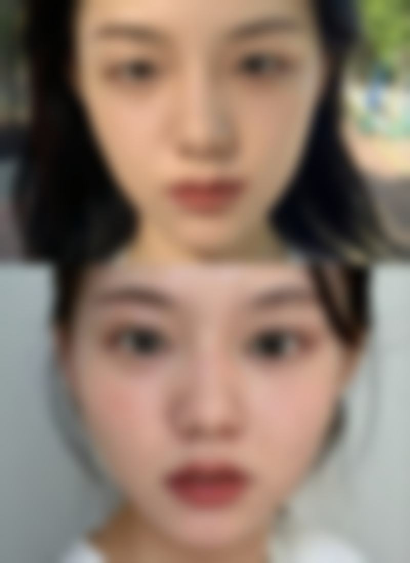 青岛永缘韩美整形美容医院特色项目及技术优势