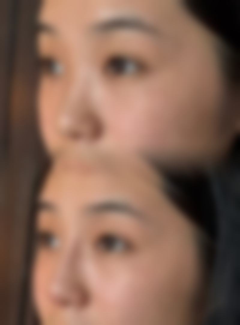 合肥好肤恒美医疗美容门诊部(庐阳院区)求美者反馈