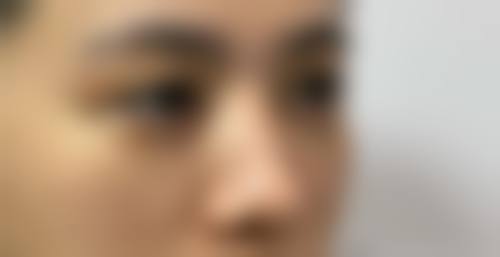 平凉康美整形医院收费价格表
