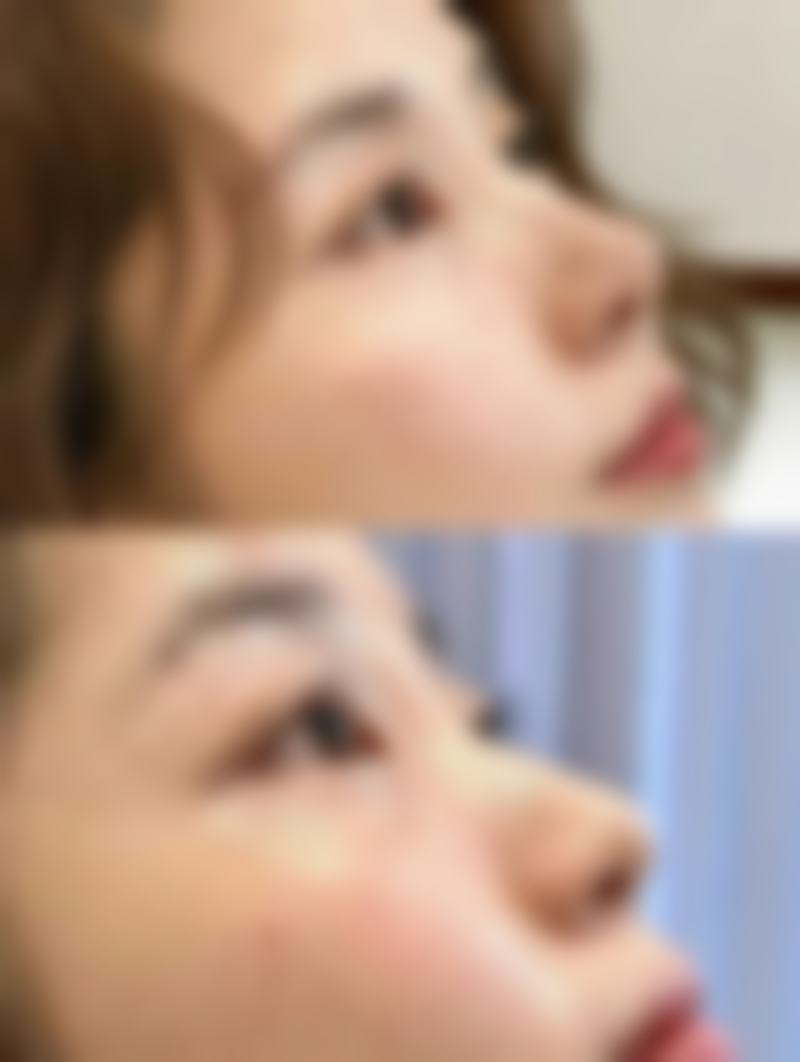 福州明宇医疗美容诊所是正规的吗