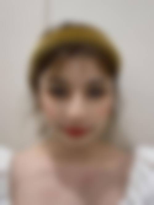武汉大学中南医院整形美容科是正规的吗