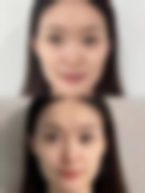 武汉大学中南医院整形美容科怎么样预约挂号