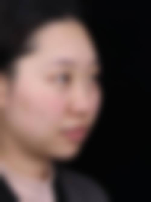 松滋颜美整形医院是正规的吗/怎么样/靠谱吗