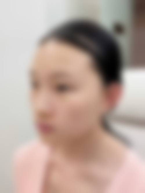 福州周江衡爱凝隆美尔整形医院收费价格表