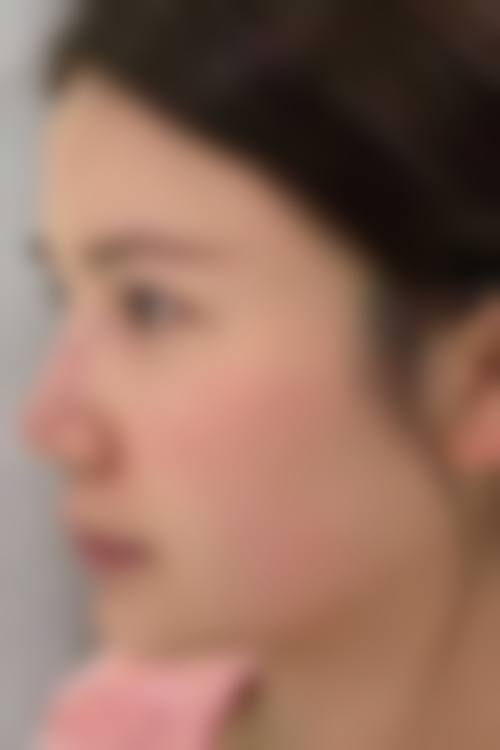 为什么要选择福州周江衡爱凝隆美尔整形医院?