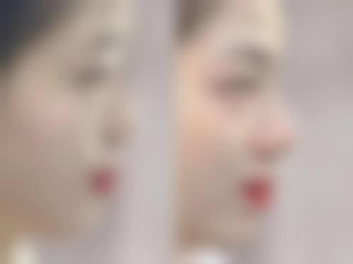 福州周江衡爱凝隆美尔整形医院怎么样预约挂号