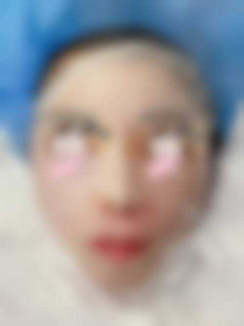 福州贝尔整形美容医院口碑怎么样
