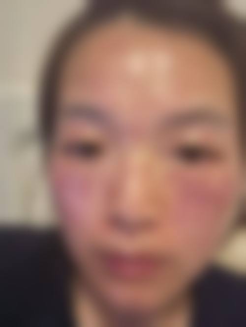 德阳美康皮肤病专科医院医疗美容科特色项目及技术优势