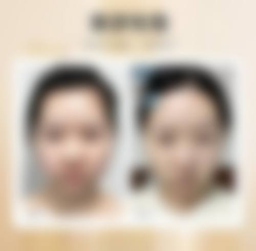 金华新美整形医院特色项目及技术优势