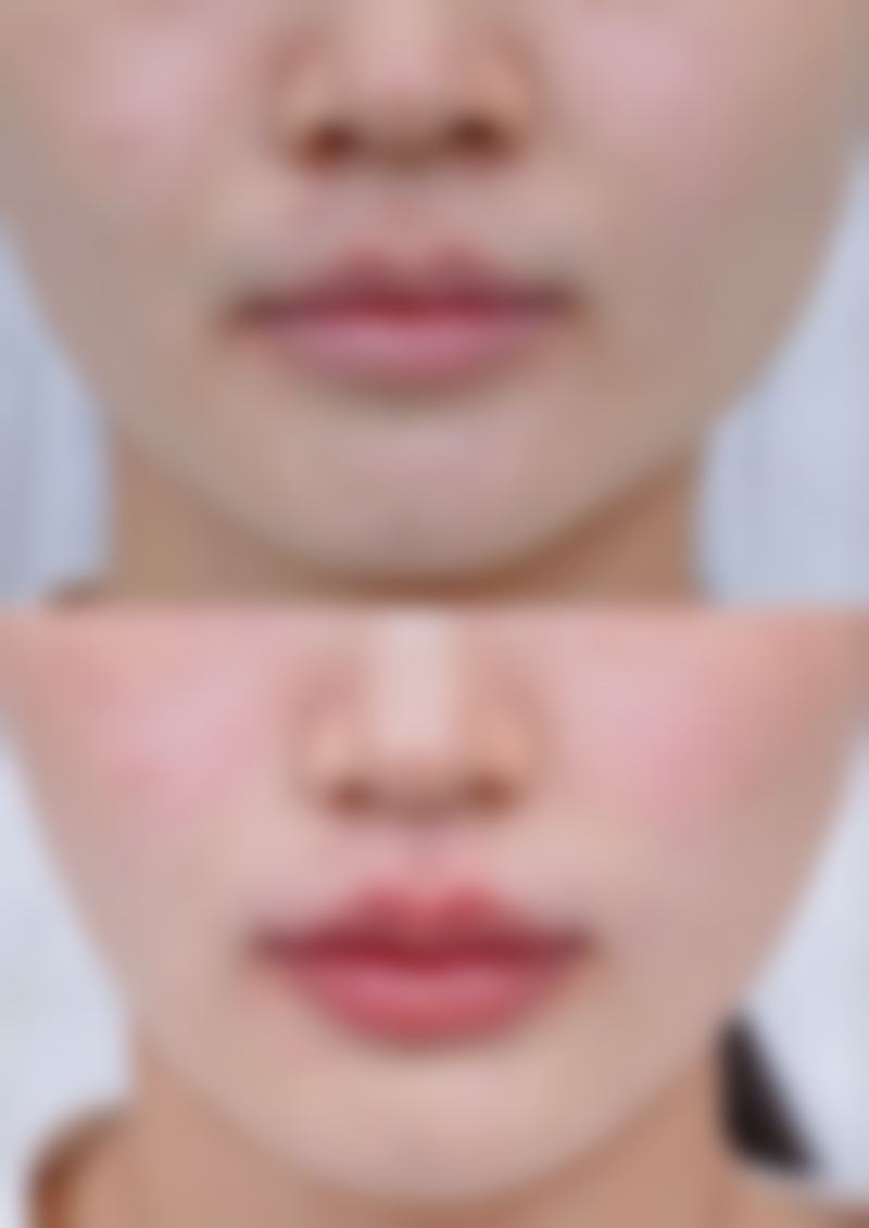 为什么要选择右江民族医学校附属医院(手足外科、小儿骨科、运动医学)?