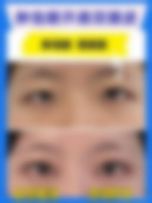 南充衡美医疗美容门诊部口碑怎么样