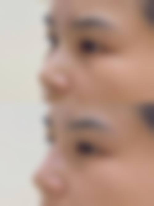 天津黛颜整形医院收费价格表