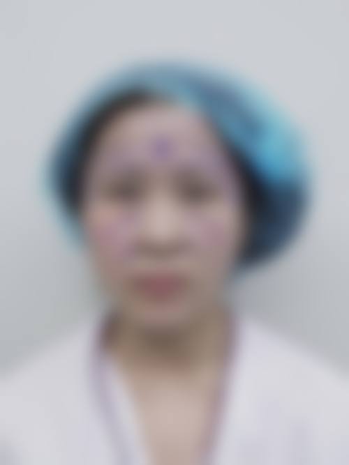童芸的价格收费与坐诊时间