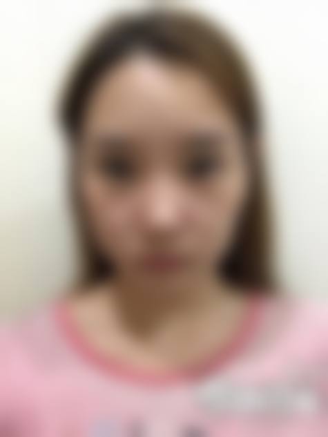 童芸的临床实战与真实实例