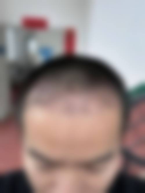 杭州西芷医疗美容怎么样预约挂号