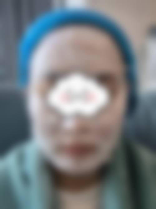 为什么要选择齐齐哈尔绣颜挚美医疗美容门诊部?