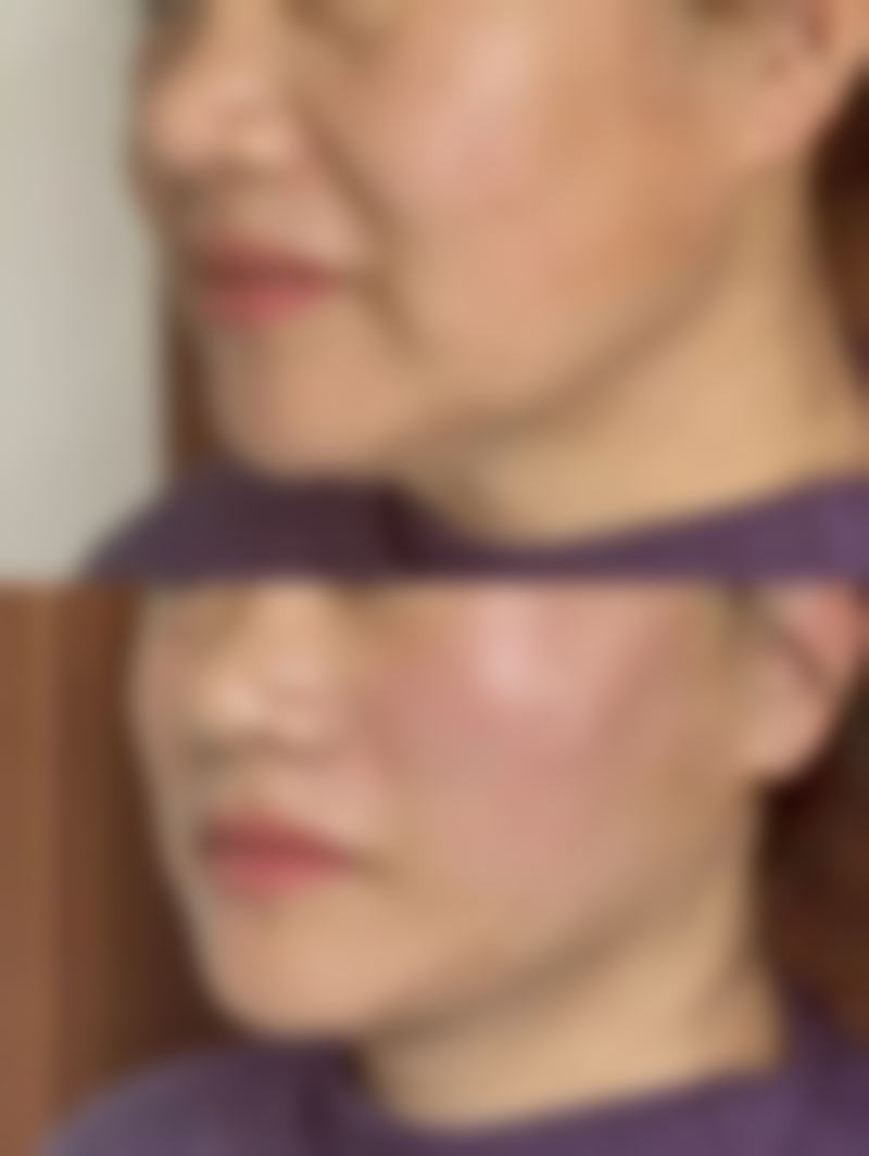 武汉宛如星生整形医院是正规的吗/怎么样/靠谱吗
