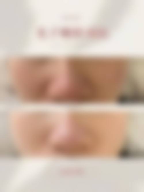 为什么要选择呼和浩特市赛罕区康医疗美容诊所?