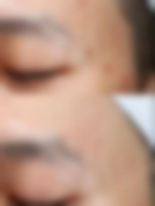 4. 杨正文的诊疗标准与服务细节