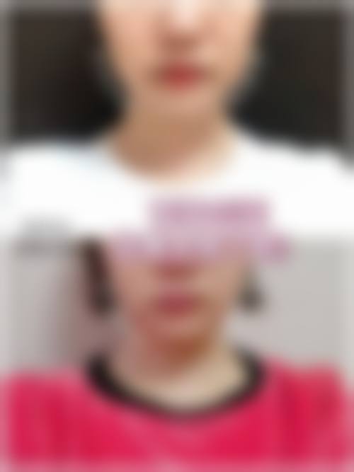 为什么要选择温州永嘉西施整形?