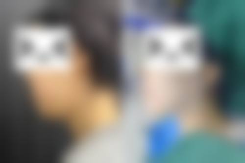 温州永嘉西施整形是正规的吗