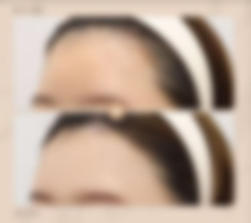 为什么要选择重庆亮剑医疗美容诊所?
