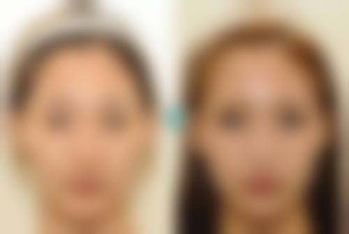 日本水户中央整形美容形成医院特色项目及技术优势
