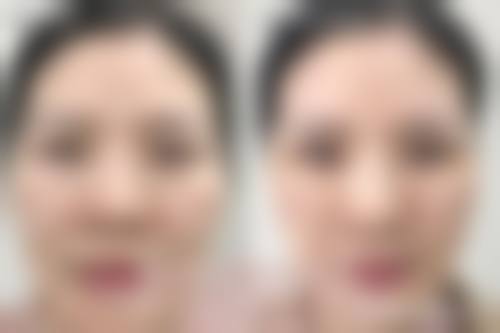 江苏徐州莱格美整形医院怎么样预约挂号