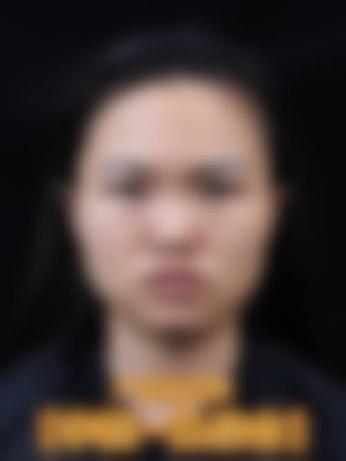 宁波鄞州容貌在线整形医院收费价格表