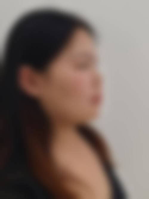 为什么要选择韩国朱诺整形外科?