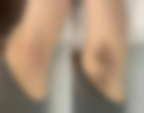厦门姮美整形美容机构口碑怎么样