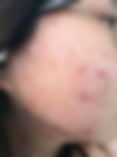 武汉同和皮肤病专科整形医院特色项目及技术优势