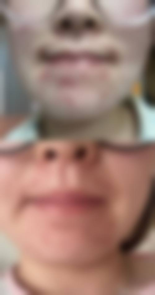 武汉同和皮肤病专科整形医院是正规的吗