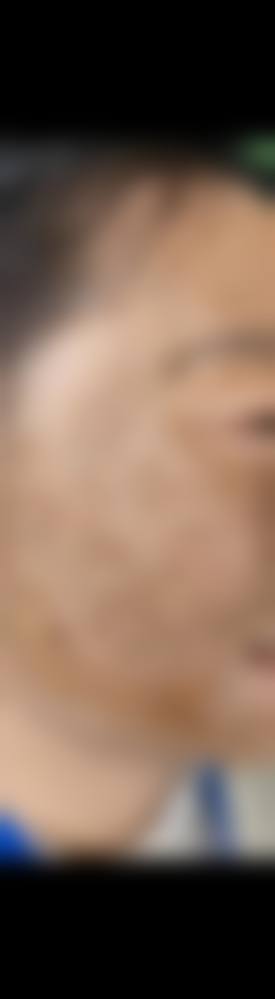 武汉同和皮肤病专科整形医院怎么样预约挂号