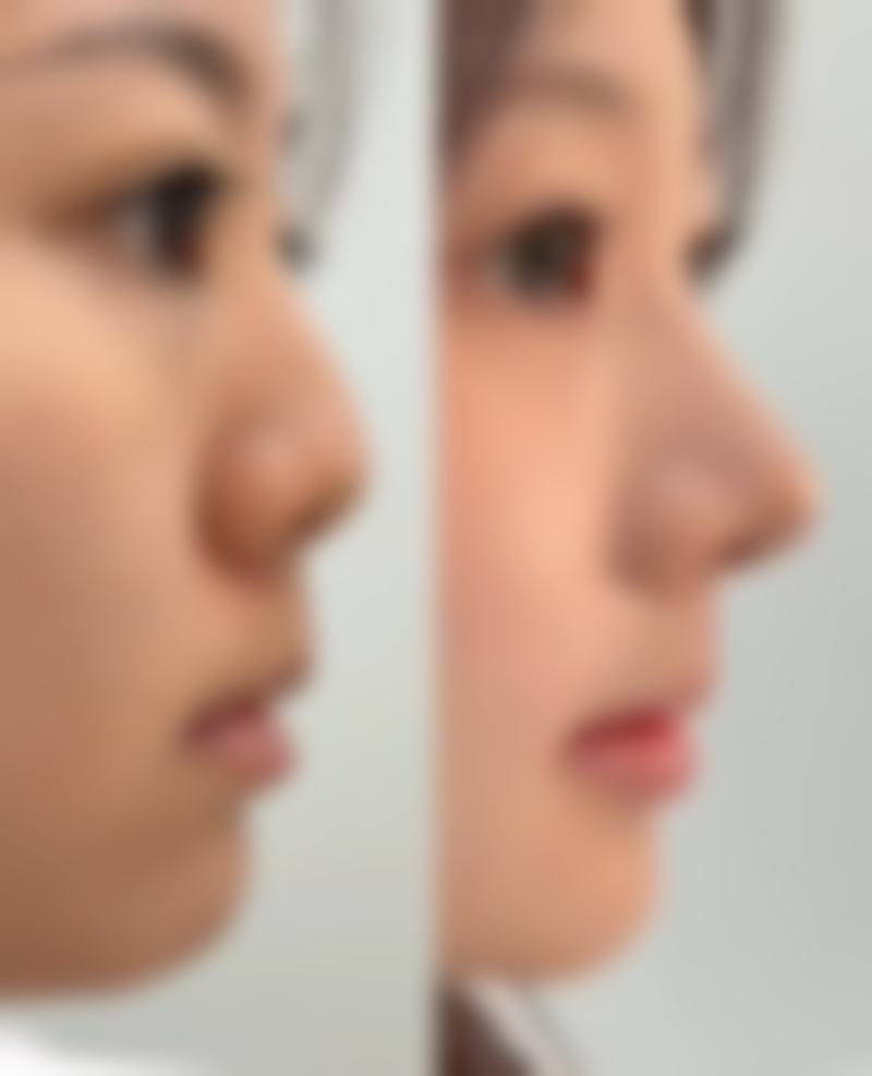 日本水户中央整形美容形成医院是正规的吗/怎么样/靠谱吗