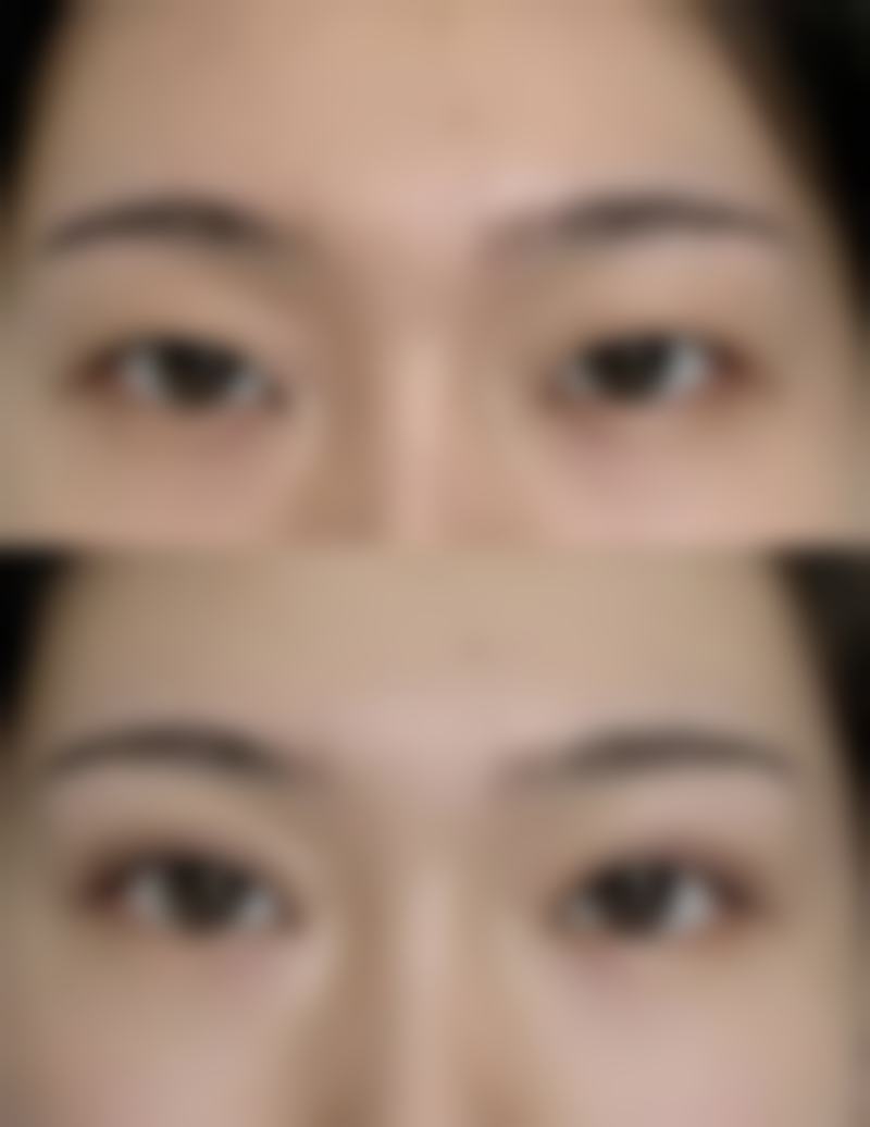 北京渼佳整形医院是正规的吗/怎么样/靠谱吗