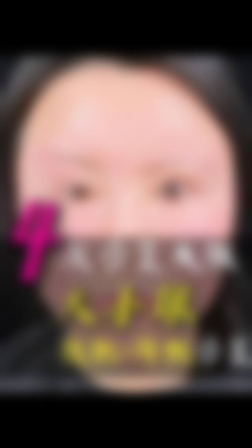 天津佳艺医疗美容诊所口碑怎么样