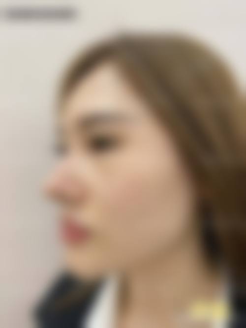 长春韩尔整形医院口碑怎么样