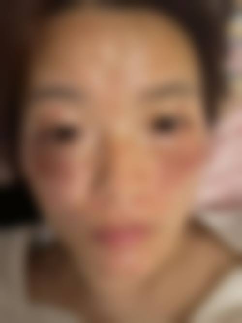 合肥美利来医疗美容收费价格表