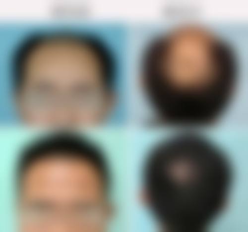 上海愉悦美联臣整形医院收费价格表