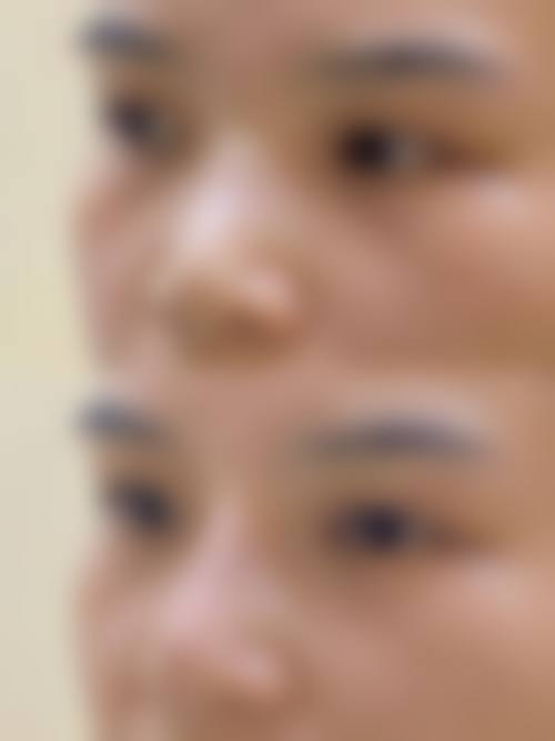 济南海佑医疗美容收费价格表