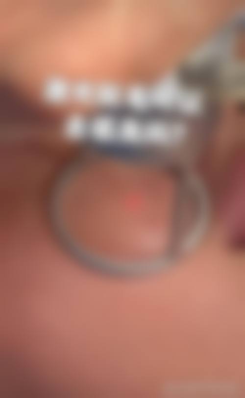 盐城湘柠整形医院是正规的吗
