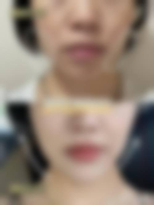 为什么要选择连云港奥泽整形美容?
